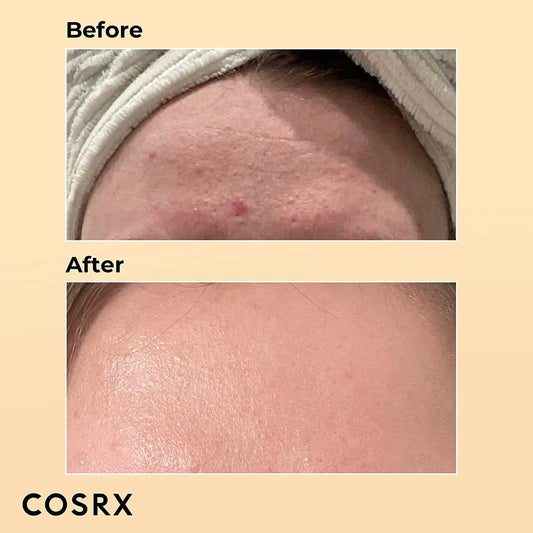 COSRX Advanced Snail 96 Mucin Power Essence - 100ml